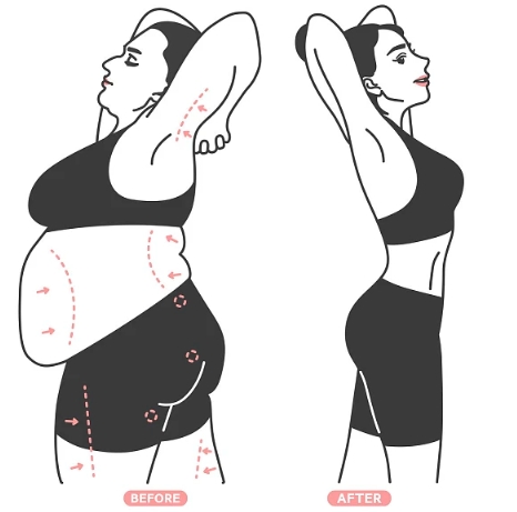 北京柏麗醫(yī)療美容醫(yī)院吸脂怎么樣？案例分享/醫(yī)院實力分析