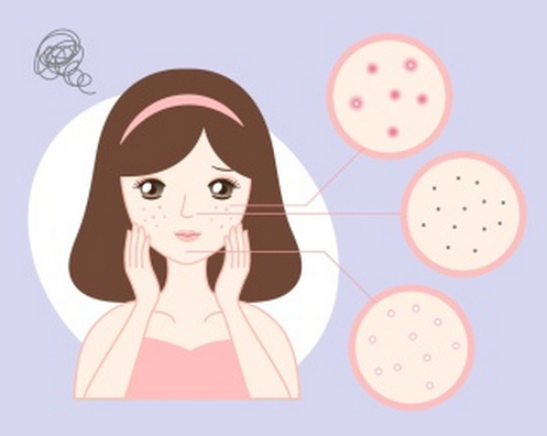 沈陽七院美容科點雀斑多少錢？費用標準參考，查看案例效果