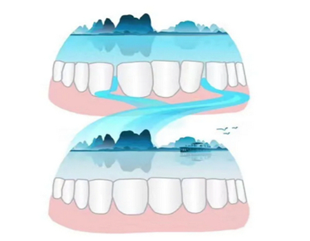 廈門矯正牙齒價(jià)格多少錢？揭曉三家實(shí)力機(jī)構(gòu)