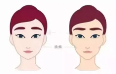 面部溶脂1.png 面部溶脂1.png