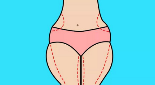 西安亞太整形美容醫(yī)院吸脂減肥技術(shù)如何？科室信息&案例分享