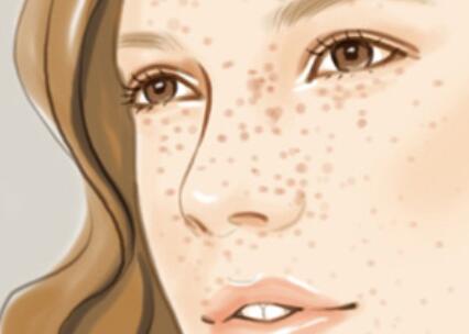 襄陽激光祛斑價格多少錢？重磅更新top3醫(yī)院排名