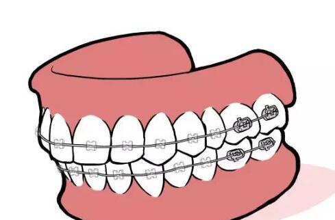 杭州牙齒矯正價格是多少？公布前三機(jī)構(gòu)排名