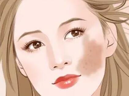 唐山市做祛疤痕價格是多少？附上三家詳細(xì)的醫(yī)院信息