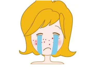 廣州軍區(qū)總醫(yī)院激光去痘坑要多少錢(qián)？讓你的皮膚重?zé)ㄐ律?附案例