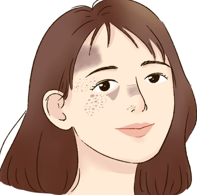 上海瑞金醫(yī)院燒傷科劉琰醫(yī)生怎么樣？祛疤案例效果預(yù)覽+費(fèi)用