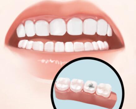 北京做種植牙價格多少？價格詳情了解，醫(yī)院名單盤點(diǎn)！