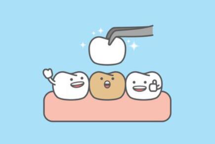 重慶做補(bǔ)牙價格是多少？補(bǔ)牙的費(fèi)用50元起，附醫(yī)院推薦