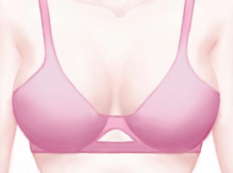 上海假體奧美定取出價格貴不貴？盤點技術(shù)醫(yī)院供參考