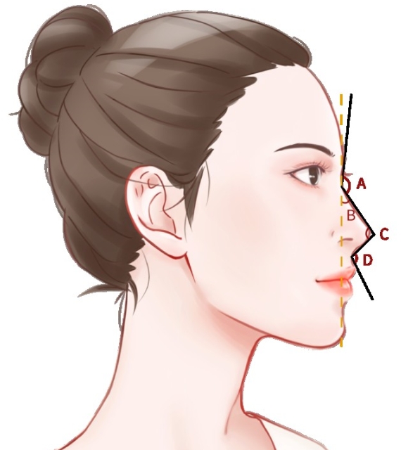 西安喬雅登玻尿酸打鼻子多少錢？更新實力靠前的醫(yī)美醫(yī)院介紹