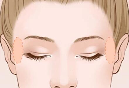 合肥做面部填充價格是多少？公布口碑醫(yī)院名單