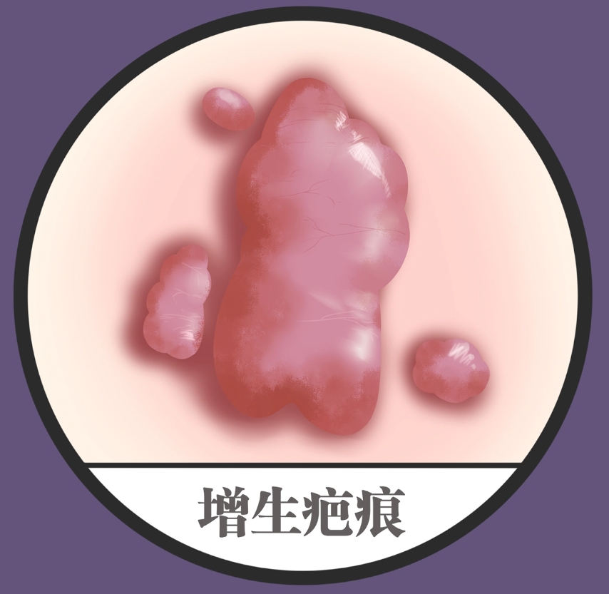 內(nèi)蒙古自治區(qū)人民醫(yī)院整形燒傷外科燒傷修復(fù)好不好？價格表和醫(yī)院信息速來了解