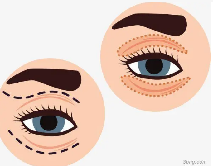 貴陽(yáng)第一人民醫(yī)院可以割雙眼皮嗎?案例\專家信息速來(lái)了解