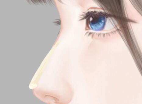 成都做隆鼻價格多少？實力醫(yī)院科普和價格咨詢了解