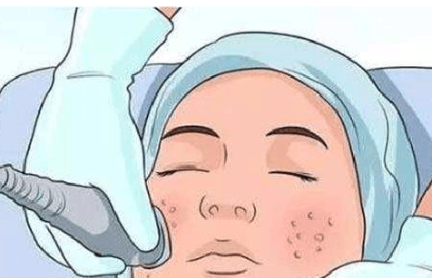 蘇州黃金微針一次要多少錢?3家熱門強(qiáng)院驚喜上線