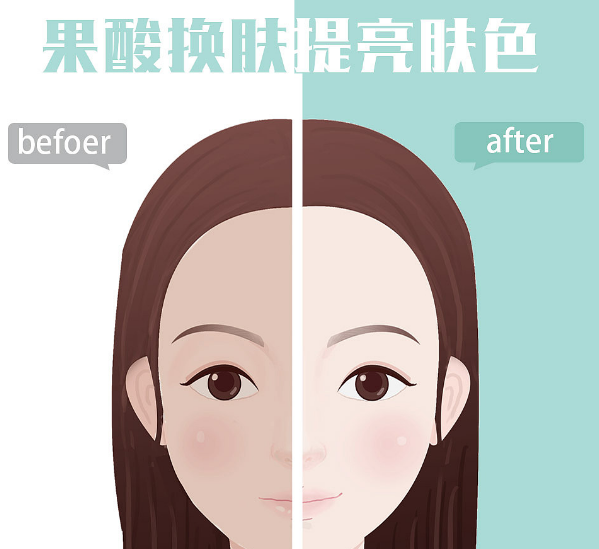 烏魯木齊果酸換膚多少錢一次?這三家醫(yī)院實(shí)力不容小覷！