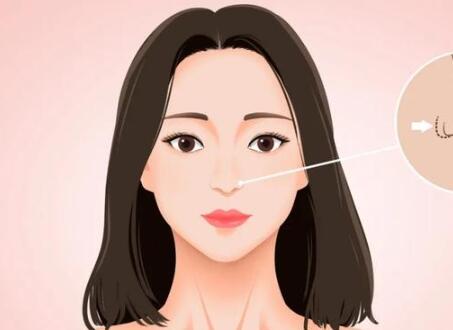 濟(jì)南玻尿酸填充多少錢？優(yōu)選口碑好的醫(yī)美醫(yī)院供參考