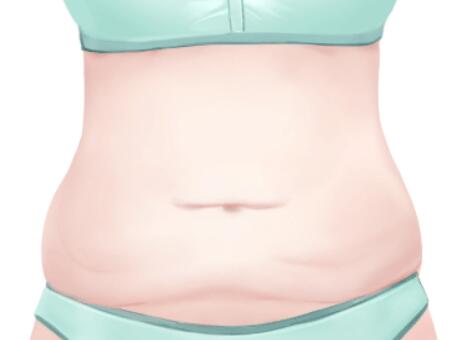 常州腹部抽脂肪要多少錢？?jī)?yōu)選實(shí)力醫(yī)美醫(yī)院