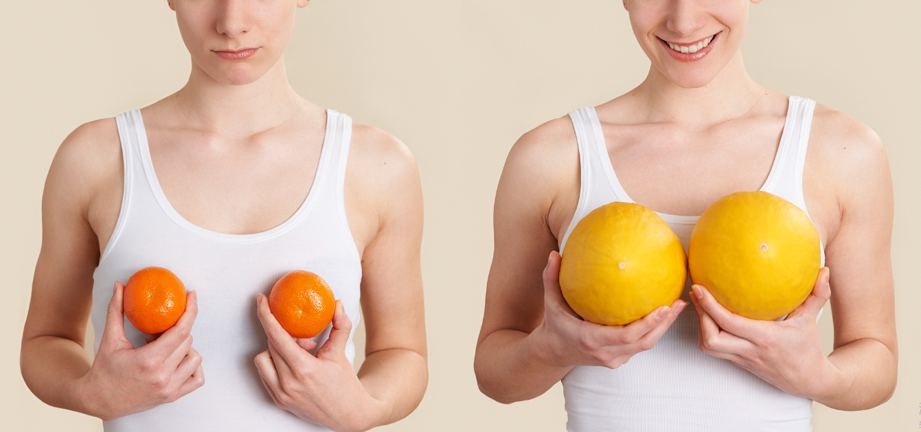 臨沂做乳房提升術(shù)多少錢？?jī)?yōu)選前三豐胸整形機(jī)構(gòu)名單