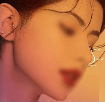 寧波硅膠隆鼻大概多少錢？含人氣醫(yī)美醫(yī)院前三名