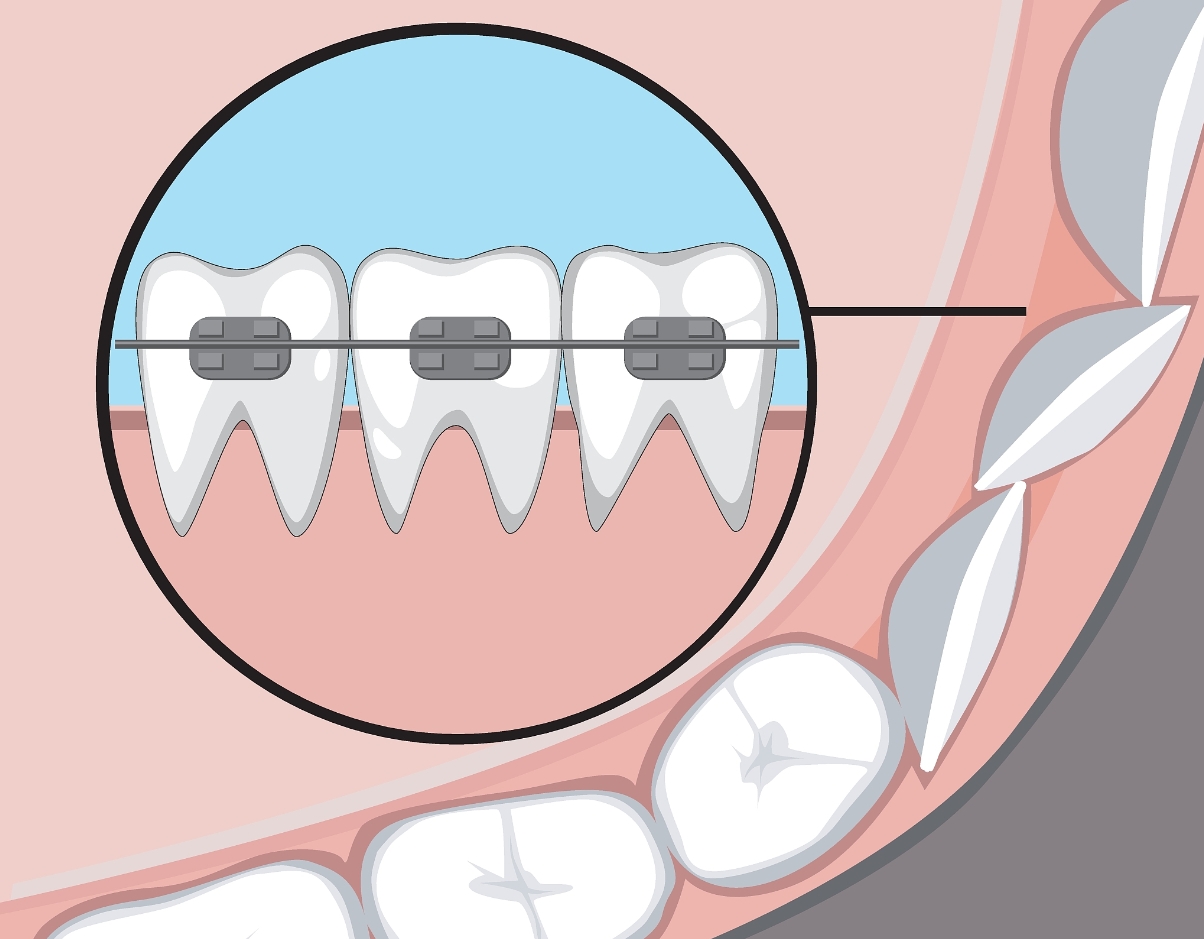昆明市婦幼保健院口腔科李俊斌怎么樣？附牙齒矯正案例+全新價格表