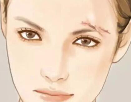 廈門祛疤價格多少？祛疤方式有哪些？醫(yī)院盤點