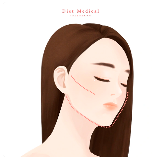 南昌全臉超聲炮多少錢?榜單中的專家個個技術