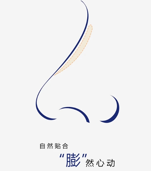 全國膨體隆鼻手術(shù)需要多少錢？盤點三家醫(yī)美醫(yī)院來了