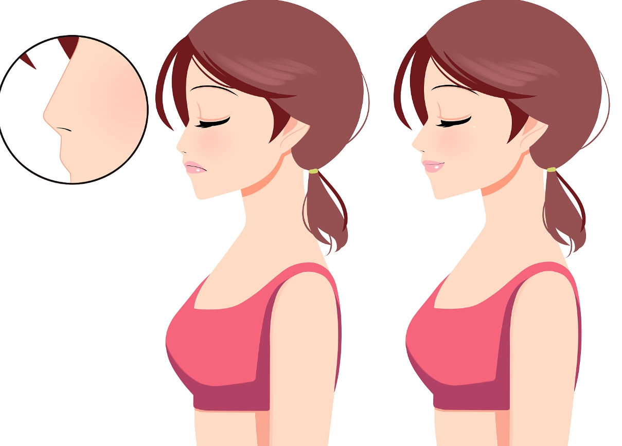 上海第九人民醫(yī)院整形科昝濤技術(shù)好嗎?假體隆鼻效果怎么樣?案例一覽