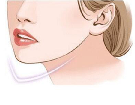 常州豐下巴價格多少？分享前3醫(yī)院名單