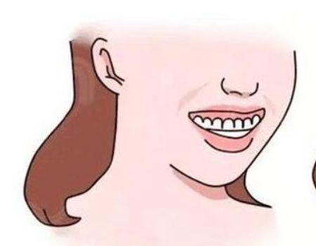 北京磨骨整形價格多少？清大玉泉醫(yī)院、八大處以及世紀醫(yī)院上榜