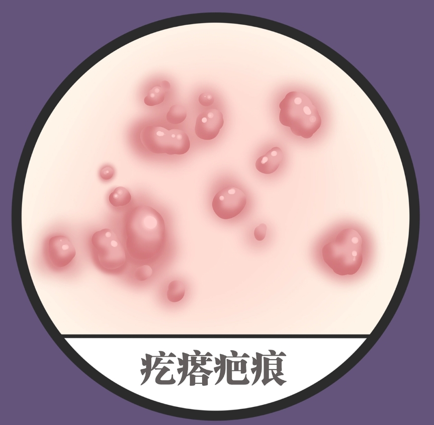 延安大學(xué)附屬醫(yī)院燒傷整形外科疤痕修復(fù)手術(shù)、醫(yī)院簡(jiǎn)介和詳細(xì)價(jià)格表一覽