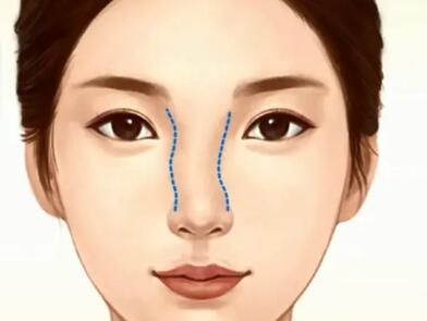 威海隆鼻價格是多少？預(yù)覽一下人氣醫(yī)院名單