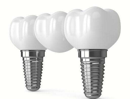 南寧做種植牙價格多少？精選3家實力醫(yī)院