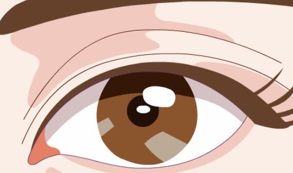 杭州雙眼皮價格多少？公布醫(yī)院詳細信息