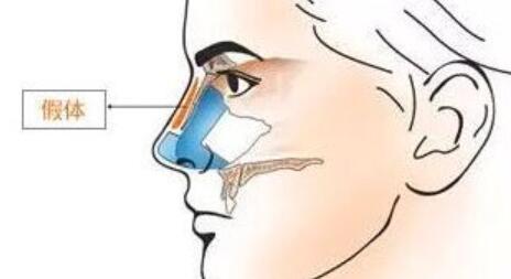 武漢隆鼻價格是多少？top榜前3醫(yī)院實力對比