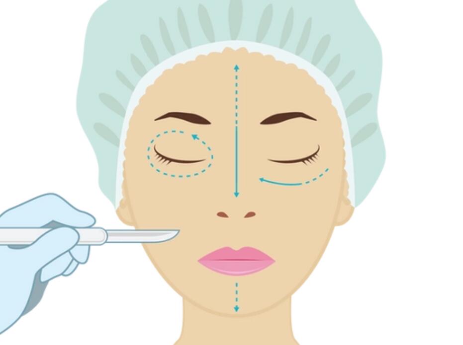 金華全切雙眼皮多少錢一般？寶藏醫(yī)美醫(yī)院不容錯過！