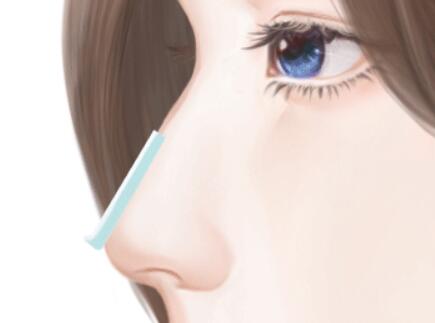 珠海隆鼻價格貴嗎？top3醫(yī)院出爐