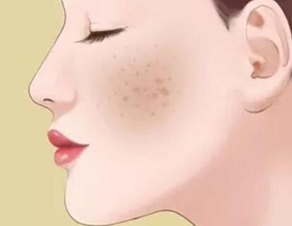 成都激光祛斑價格多少？榜單前三醫(yī)院實力了解