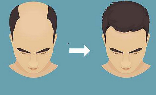 上海植發(fā)整形2024價格參考，內附實力醫(yī)院推薦+案例