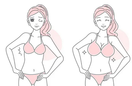 貴陽隆胸整形價格貴嗎？內附實力醫(yī)院推薦+案例