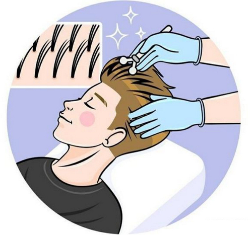 重慶植發(fā)整形案例在線查看，內附案例+實力醫(yī)院推薦