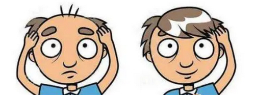 昆明植發(fā)整形2024價格參考，內(nèi)附實力醫(yī)院推薦