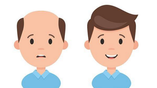 鄭州植發(fā)整形2024價格參考，內附實力醫(yī)院推薦