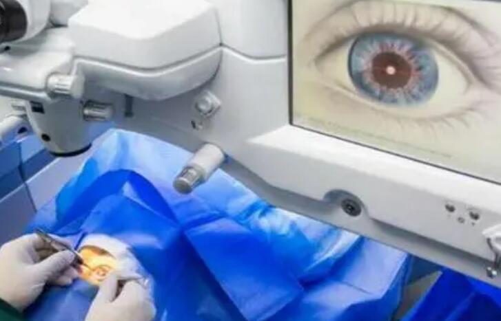 邢臺(tái)做近視眼手術(shù)多少錢(qián)?這三家眼科醫(yī)院實(shí)力拉滿(mǎn)