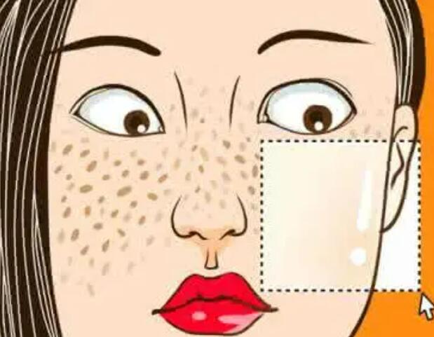 安陽皮秒激光祛斑一次大概多少錢?好評整形醫(yī)院如約而至