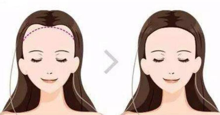 黃岡發(fā)際線種植多少錢?這三家醫(yī)院值得考慮!