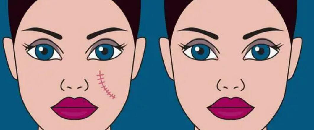 株洲激光去疤多少錢?大熱實力醫(yī)院集合