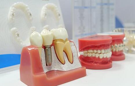 青島種植牙價(jià)格是多少？點(diǎn)擊了解相關(guān)的醫(yī)院排名