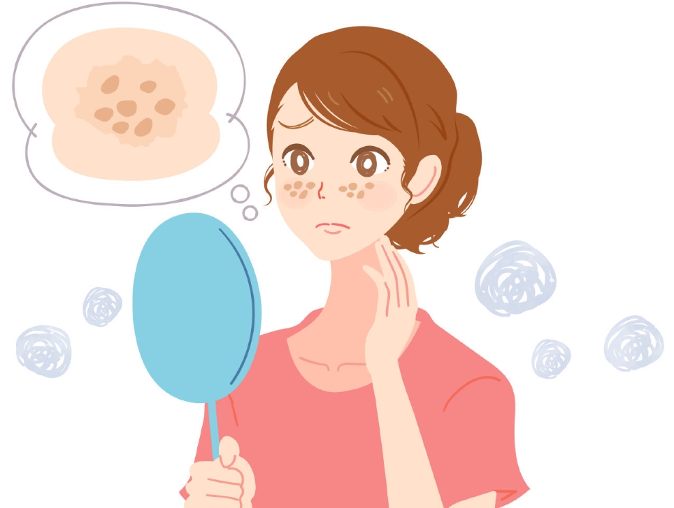 簡陽人民醫(yī)院祛斑怎么樣？實(shí)力醫(yī)生推薦+激光祛斑案例分享